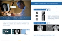 Yang Eva Portable X-Ray with inbuilt DR Systems - Portable